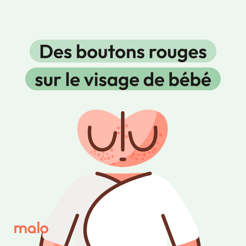 Boutons rouge sur le visage d'un nouveau-né, illustré par l'application Malo