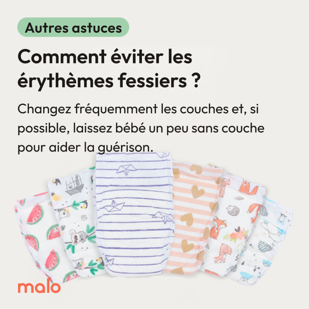 Conseils de Malo pour éviter les érythèmes fessiers est de changer les couches régulièrement pour éviter les fesses rouges de bébé